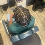 Scalp Treatment