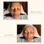 Deep pore Facial