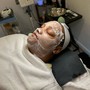 Dermaplaning Facial