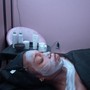 Oxygen Facial