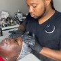 Microdermabrasion