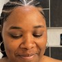 Scalp Treatment