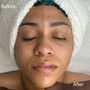 Revitalizing Facial