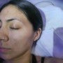 DIAMOND MICRODERMABRASION