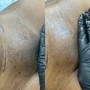 Full Brazilian Wax