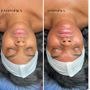 Dermaplaning Near Me Chantilly VA Appointments StyleSeat