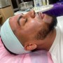 Microdermabrasion