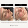 Clinically Clarifying Deep Pore Facial Treatment