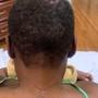 Scalp Treatment