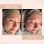 Deep pore Facial