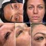 Eyebrow: Microblading