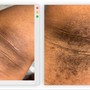 Men’s Brazilian Wax