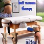 Butt vacuum therapy