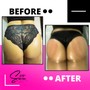 1 Cellulite Reduction Session