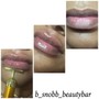 Lip Sugaring