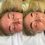 Eyelash Extension Removal W/O Full Set