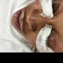 Eyelash Extension Removal