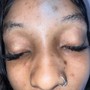 Eyelash Extension Removal