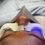 Eyelash Extension Removal