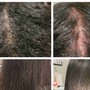 Grey hair treatment