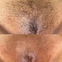 Men’s Brazilian Sugaring