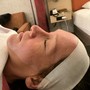 Acne Facial with Extractions