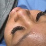 Eyelash Extension Removal