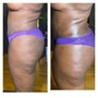 Vajacial w/ Brazilian wax