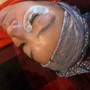 Facial Dermaplaning