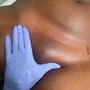 Dermaplaning