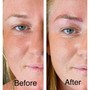 Eyebrow: Microblading