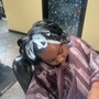 Scalp Treatment