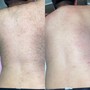 Men’s Brazilian Sugaring