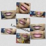 Lip Sugaring