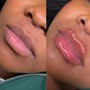 Lip filler training class