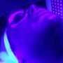 Microdermabrasion with oxygen and light therapy.