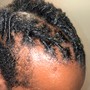 Scalp Treatment