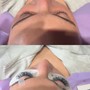 Eyelash Extension Removal