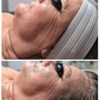 Dermaplaning Facial