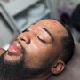 Microdermabrasion Facial