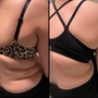 Skinny Lipo Shots