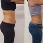 Skinny Lipo Shots