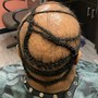 SCALP EXFOLIATION