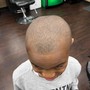 Men's Man unit  hairline repair