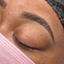 Brow Lift