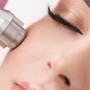 Microdermabrasion with oxygen and light therapy.