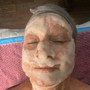 Chemical peel