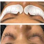 Customized Facial