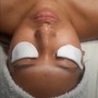 Microdermabrasion