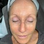 Anti Aging Facial